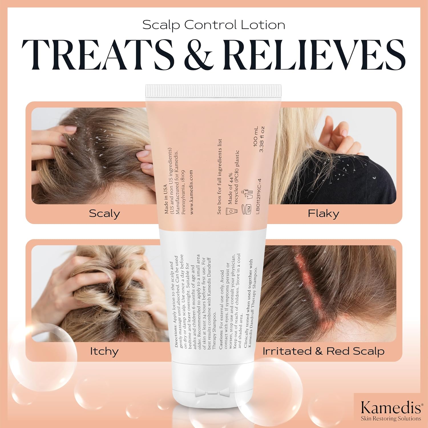 KAMEDIS Scalp Moisturizer Lotion For Dry, Itchy, Dandruff, Flaky, Seborrheic Dermatitis, Psoriasis and Sensitive Scalp. Over-Night Mask Treatment Botanicals-Based. Parabens Free. 3.38 Fl Oz. - Image 6