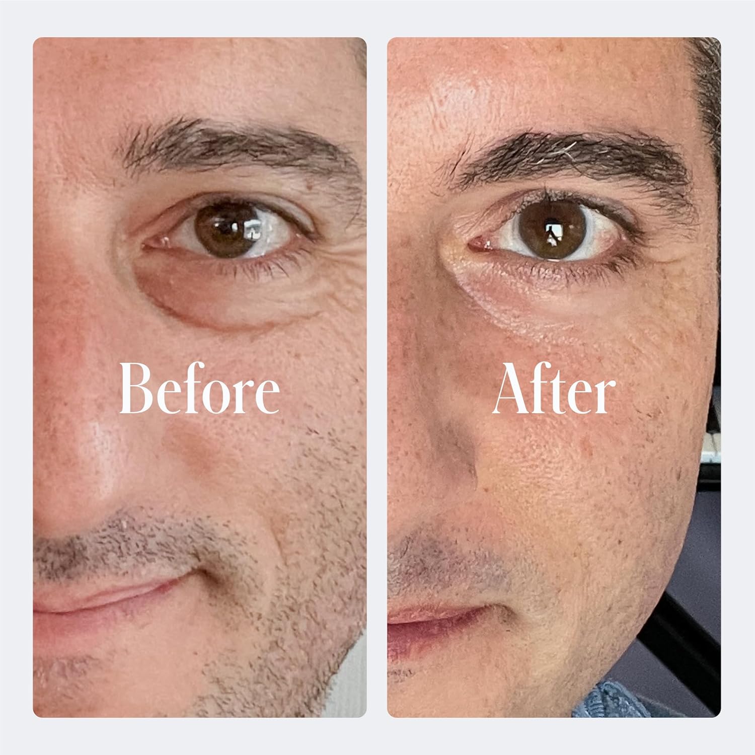 Geologie Dark Circle Under Eye Cream | Treatment For Dark Circles, Puffy Eyes Fine Lines & Wrinkles | Kojic Acid, Caffeine, Peptides, Niacinamide & Hyaluronic Acid | Effective Formula For Men & Women - Image 5