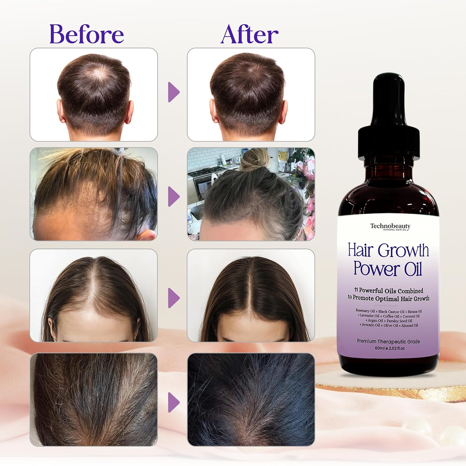 Rosemary Oil With Black Castor, Batana, Lavender, Coffee, Coconut, Argan, Avocado, Olive, Almond & Parsley Seed Oil, 11 Oils Infused for Ultimate Hair Growth & Care for Stronger, Thicker Hair - Image 4