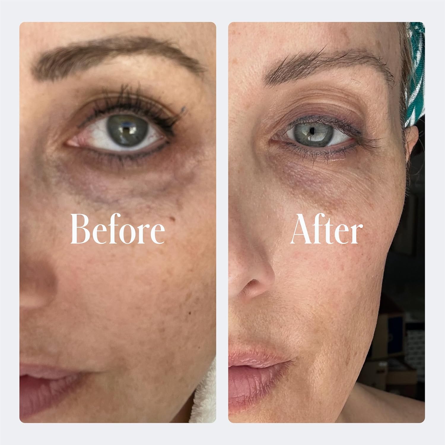 Geologie Dark Circle Under Eye Cream | Treatment For Dark Circles, Puffy Eyes Fine Lines & Wrinkles | Kojic Acid, Caffeine, Peptides, Niacinamide & Hyaluronic Acid | Effective Formula For Men & Women - Image 6