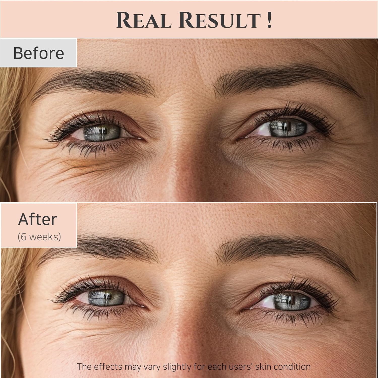 Beauty of Joseon Revive Eye Serum with Retinal Niacinamide Correction for Puffy Eye Bags Fine Lines Dark Circles Wrinkles, Korean Skin Care 30ml, 1 fl.oz, 2 Packs - Image 6